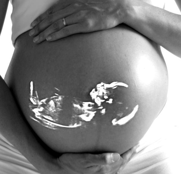 Cómo lograr un embarazo: factores que afectan la fertilidad femenina y masculina